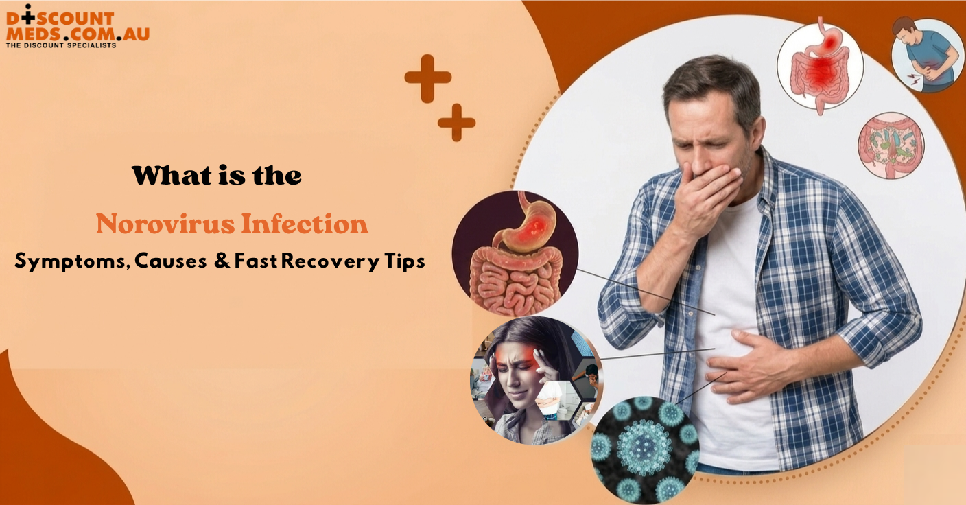 What is the Norovirus Infection: Symptoms, Causes & Fast Recovery Tips 